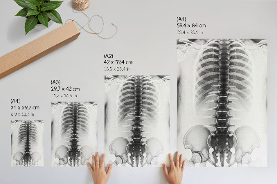 Wandposter Skelett in Schwarzweiß